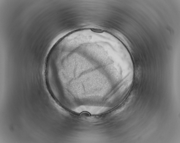 X0000111361149200908071148