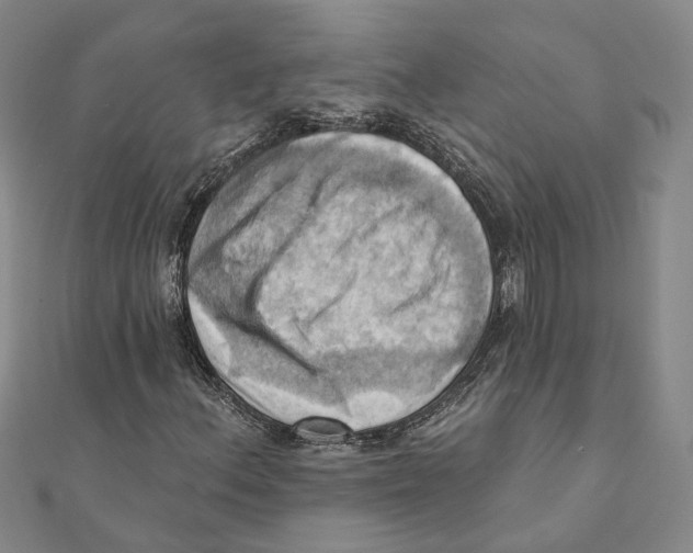 X0000111361156200908071147