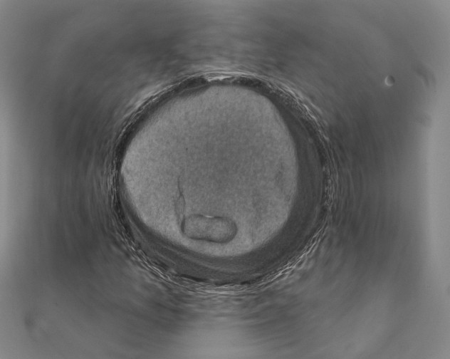 X0000111361157200908071147