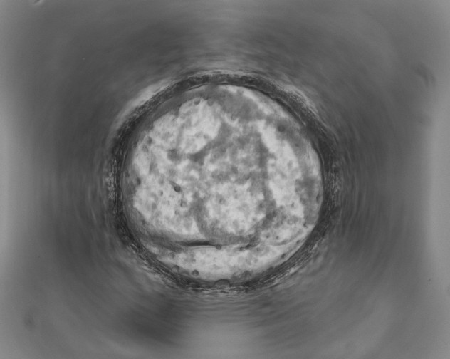 X0000111361159200908071147