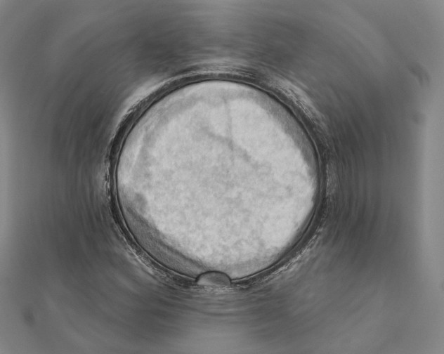 X0000111361164200908071147