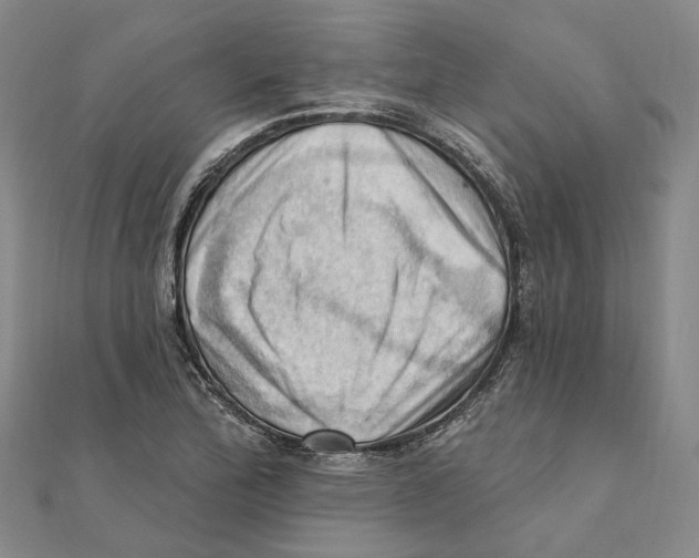 X0000111361172200908071147