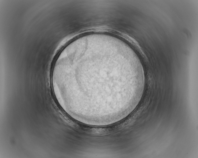 X0000111361176200908071147