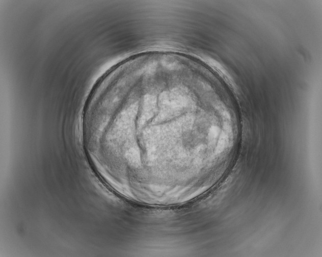 X0000111361238200908071147