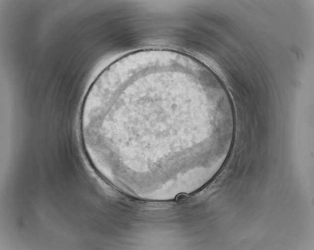 X0000111361440200908071144