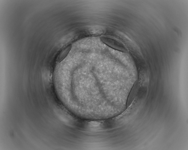 X0000111360176200908211304