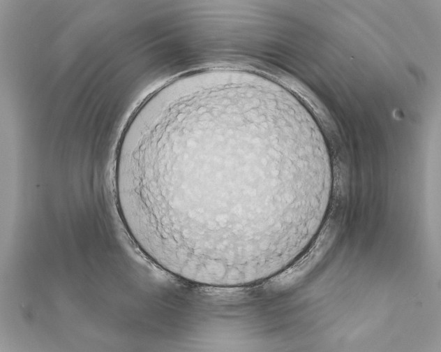 X0000111360856200908211255