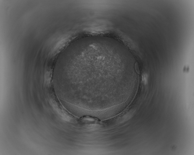 X0000111371300200907171148