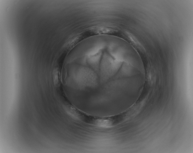 X0000111380169200907101133