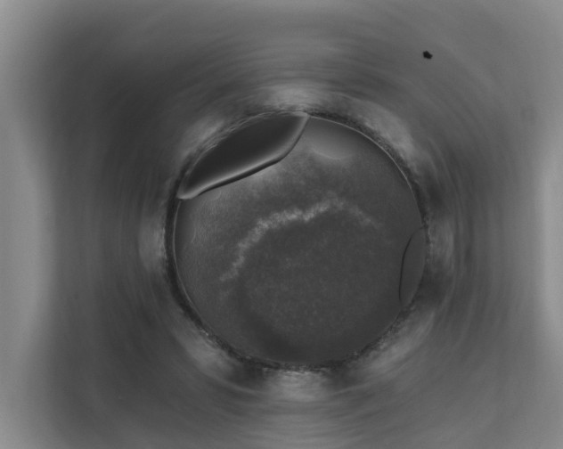 X0000111380399200907101130