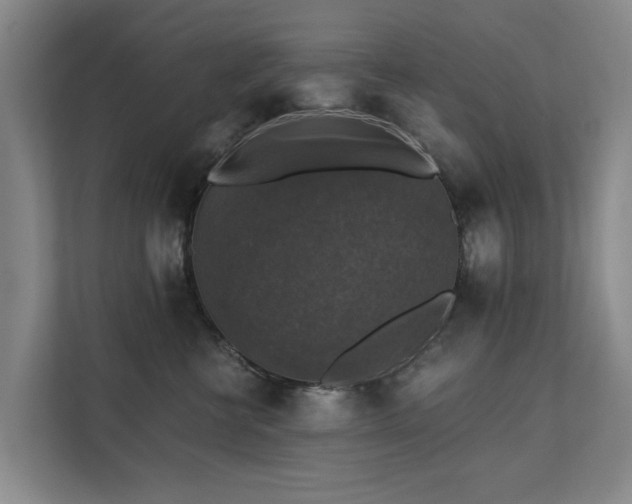 X0000111380570200907101128