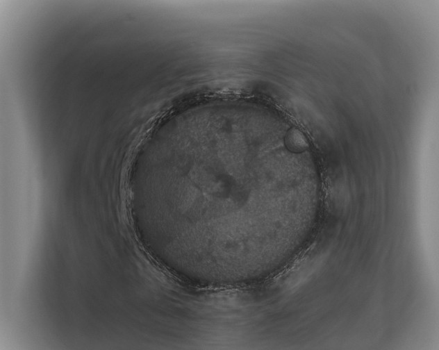 X0000111380769200907101125