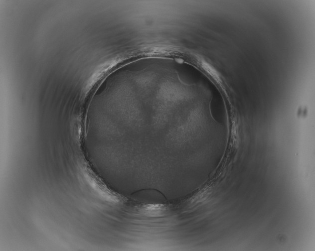 X0000111380059200907171232