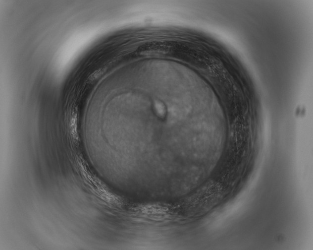 X0000111380146200907171230