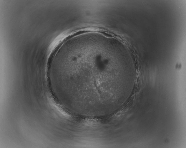 X0000111380296200907171228