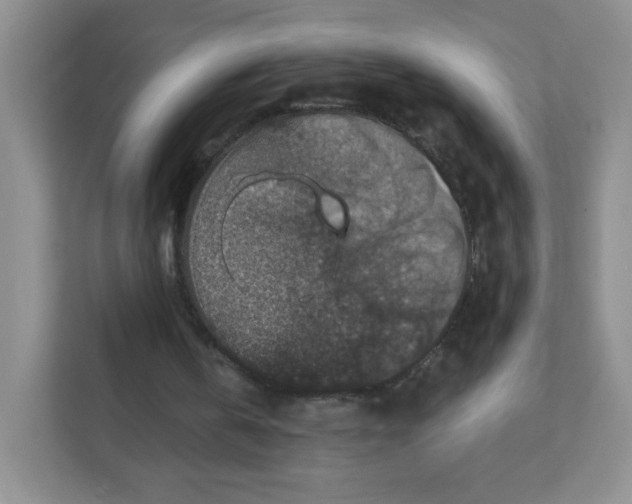 X0000111380146200907311100