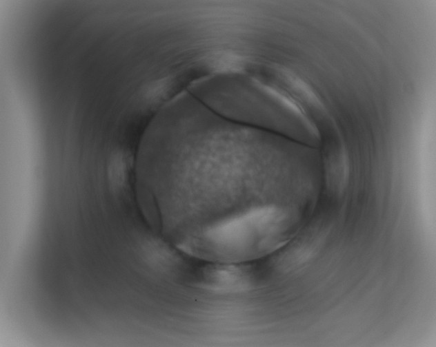 X0000111380229200907311100