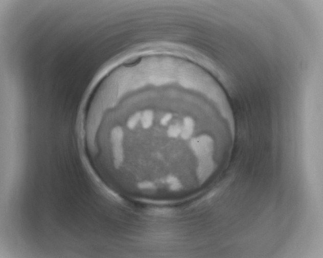 X0000111381522200907311043