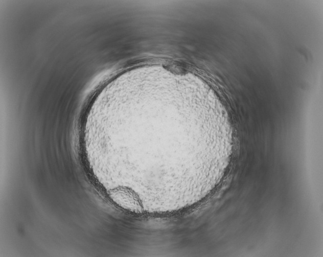 X0000111380149200908211347