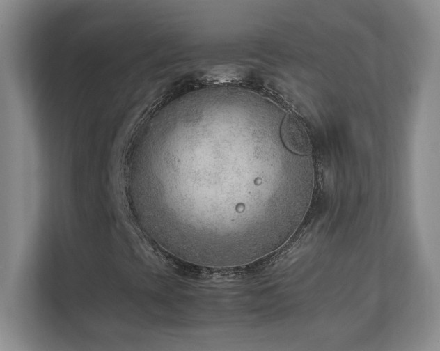 X0000111391393200907101137