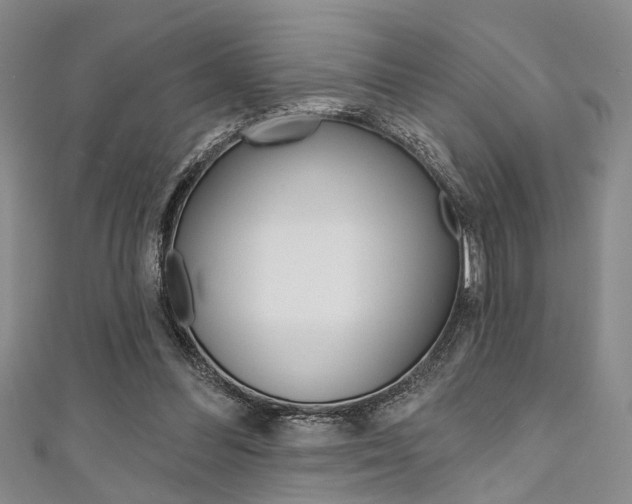 X0000111420300200907131025