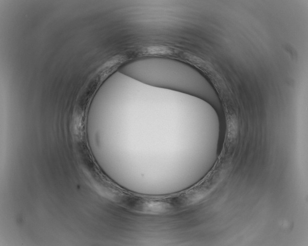 X0000111420360200907131025
