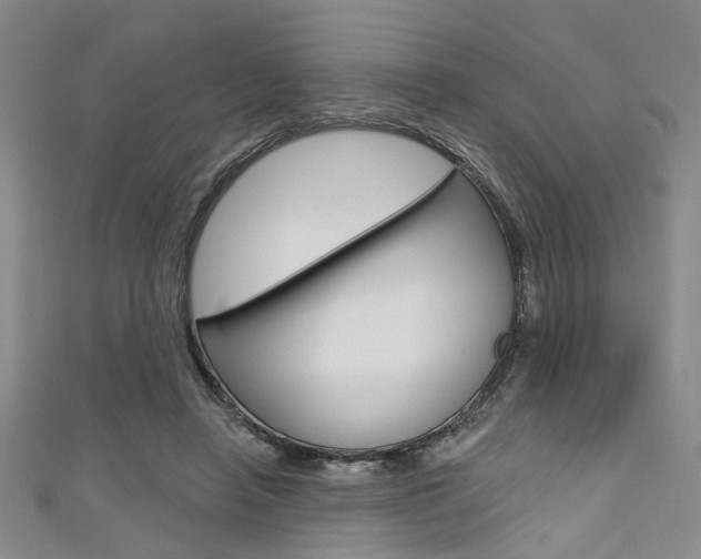 X0000111420450200907131023