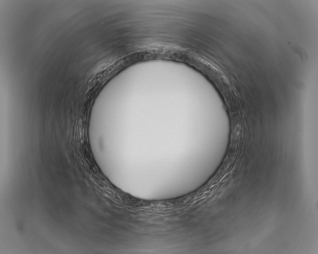 X0000111420869200907131018