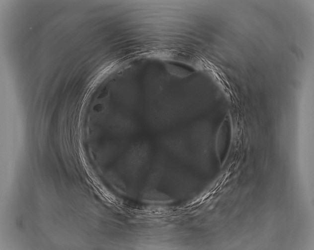 X0000111420145200907131209