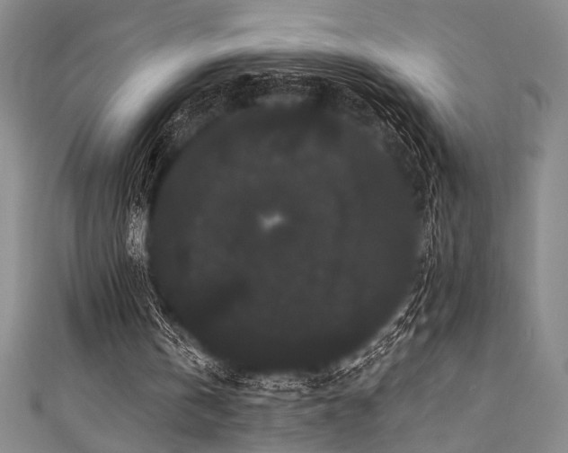 X0000111420146200907131209