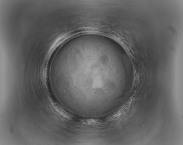 X0000111420151200907131209