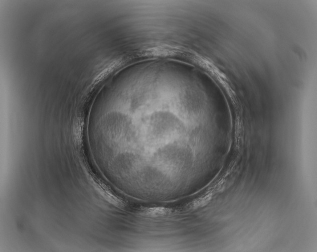 X0000111420153200907131209