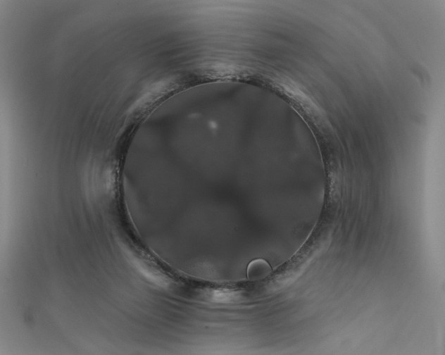 X0000111420165200907131209