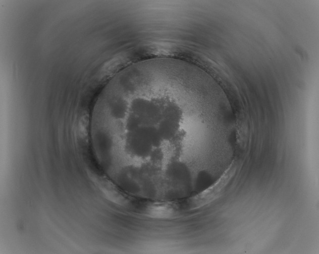 X0000111420175200907131210