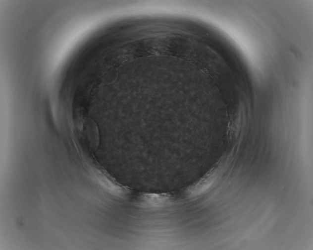 X0000111420239200907131209