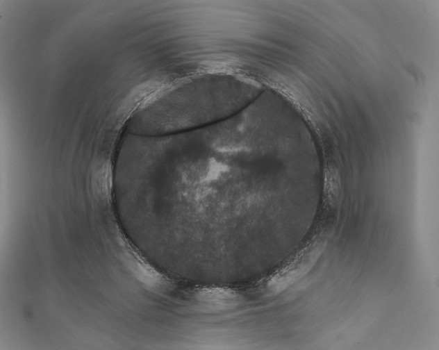 X0000111420397200907131206