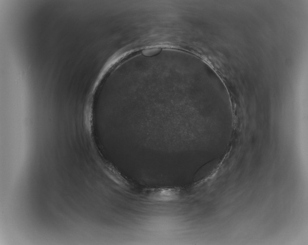 X0000111420056200907201056