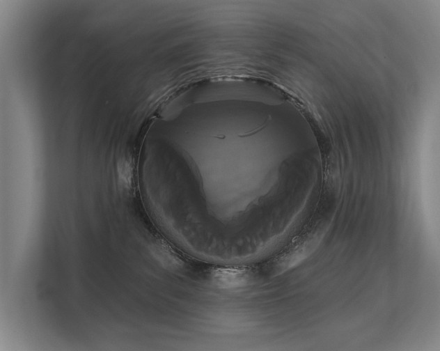 X0000111420139200907201055