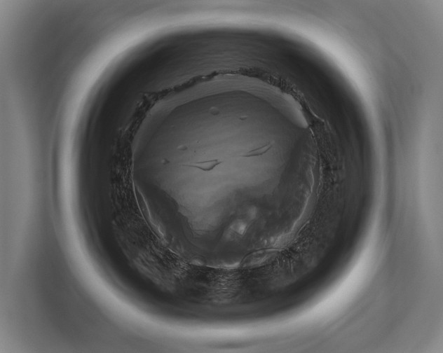 X0000111420143200907201055