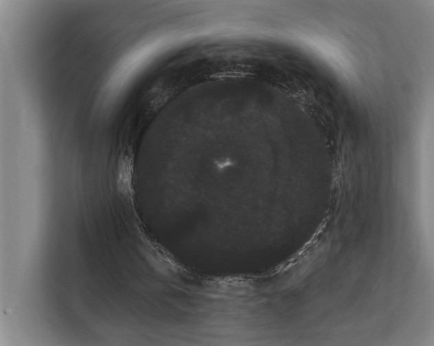 X0000111420146200907201055