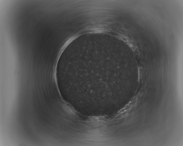 X0000111420147200907201055