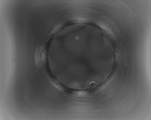 X0000111420165200907201055