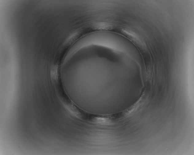 X0000111420167200907201055