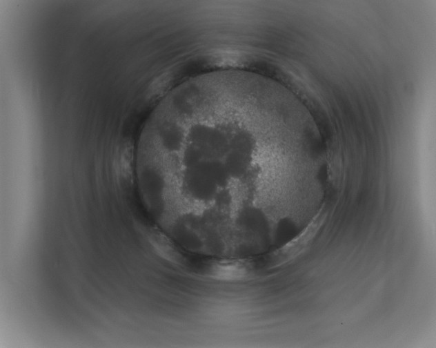 X0000111420175200907201055