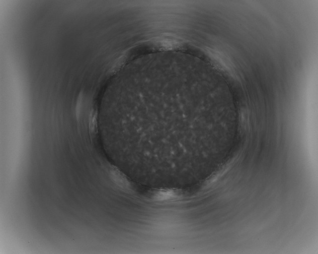 X0000111420177200907201055