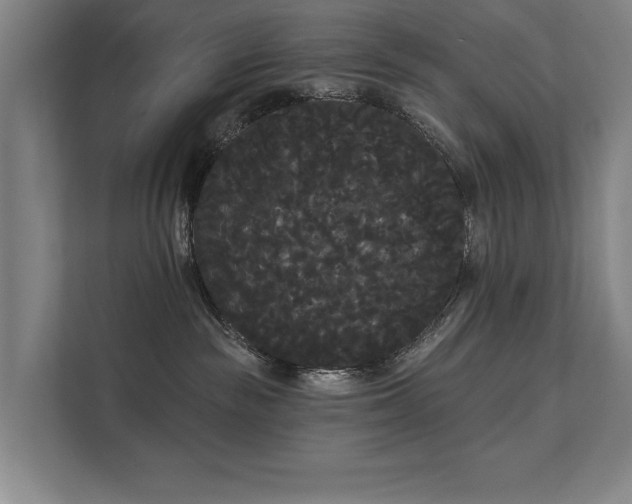 X0000111420189200907201055