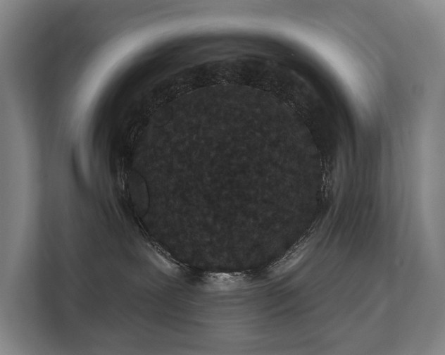 X0000111420239200907201054