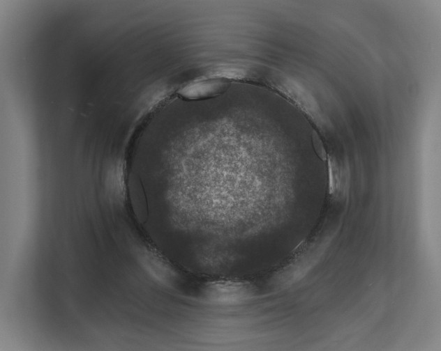 X0000111420300200907201053