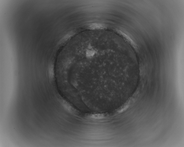 X0000111420353200907201052