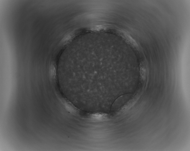 X0000111420375200907201053